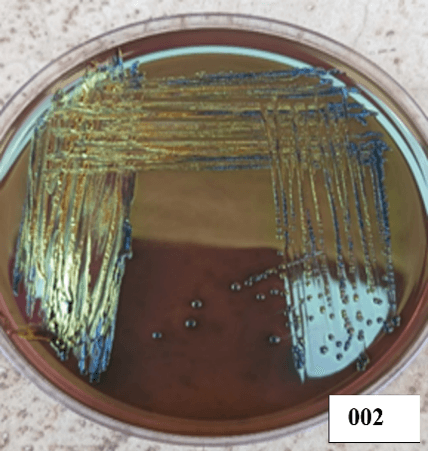 Escherichia coli microscopy Image 1