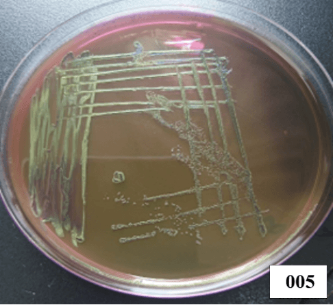 Escherichia coli microscopy Image 1