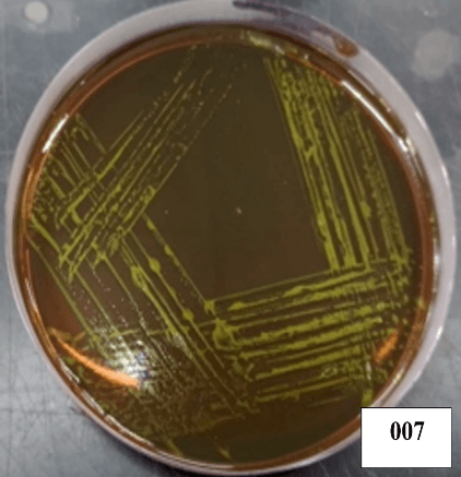 Escherichia coli microscopy Image 1