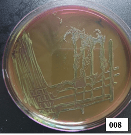 Escherichia coli microscopy Image 1