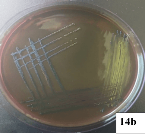 Escherichia coli microscopy Image 1