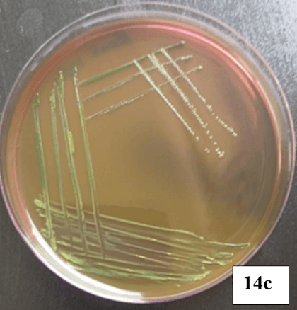 Escherichia coli microscopy Image 1