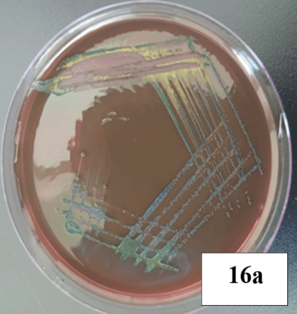 Escherichia coli microscopy Image 1