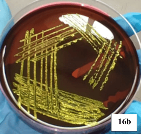Escherichia coli microscopy Image 1