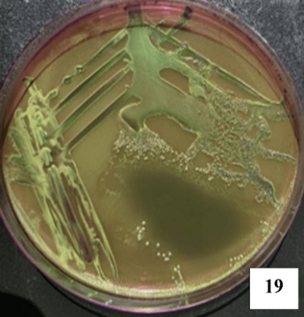 Escherichia coli microscopy Image 1